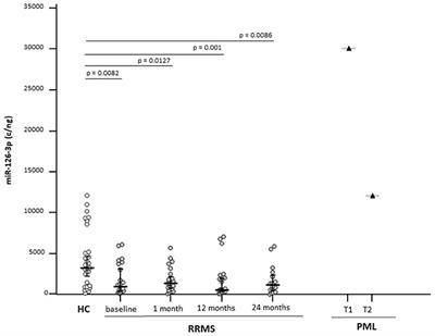 Alterations of the miR-126-3p/POU2AF1/Spi-B Axis and JCPyV Reactivation in Multiple Sclerosis Patients Receiving Natalizumab